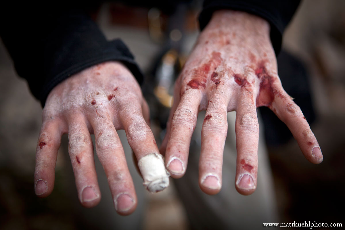 Kuehl ThrashedHands